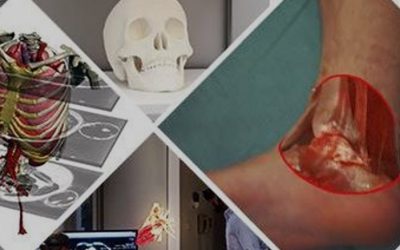 Uruguayan company that simplifies surgeries through 3D printing seeks capital in USA to open to the world